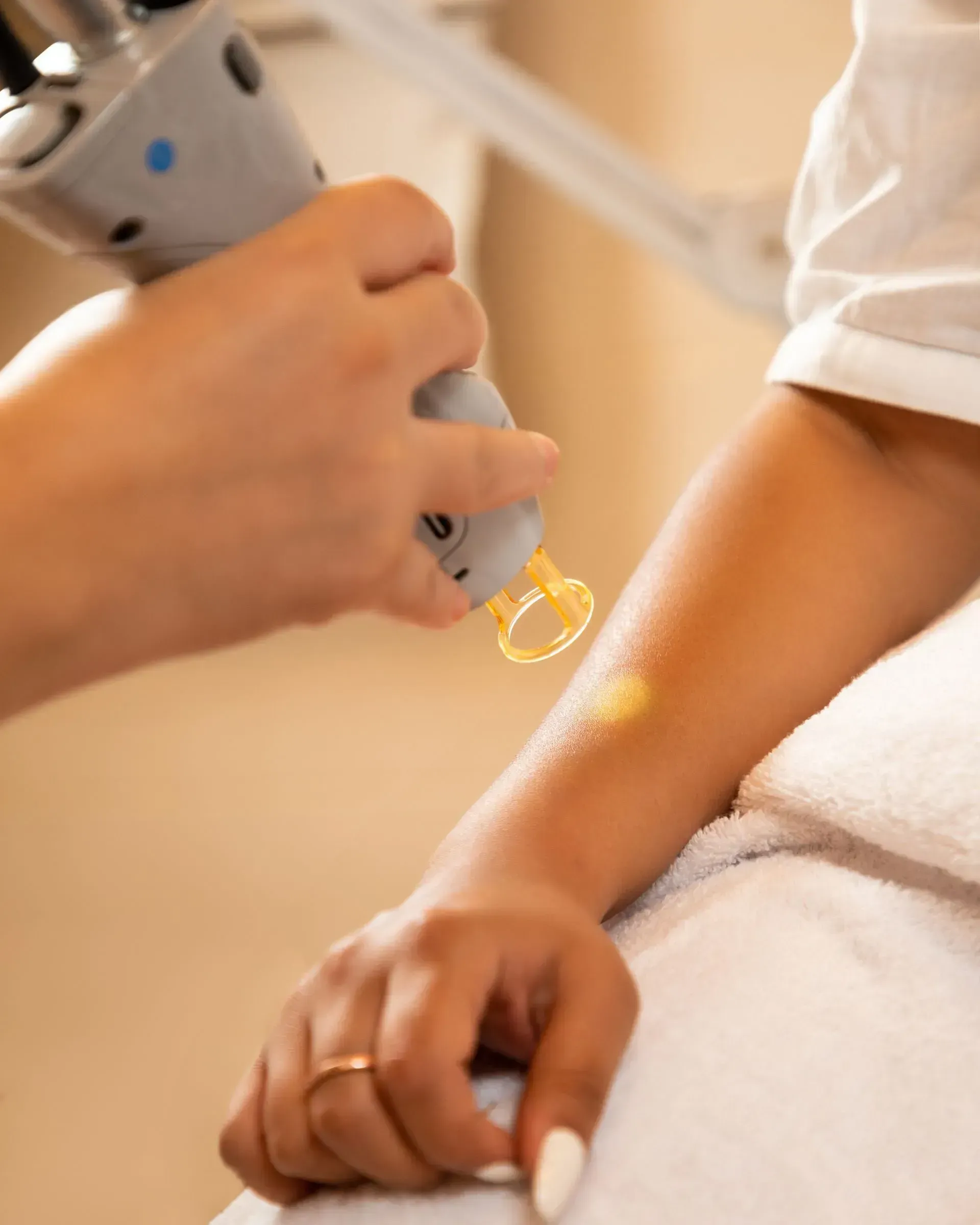 A laser hair-removal treatment — the handpiece on warm-lit skin